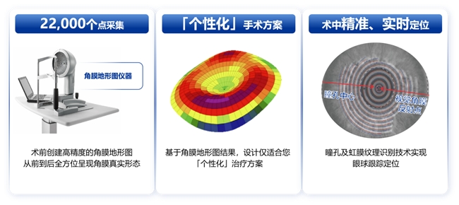 鄭州普瑞丨量眼定制獨一無二的清晰,，個性化近視手術(shù)，為您提供極致的視覺體驗,！(圖3)