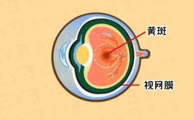 愛爾眼科：激光“打”在眼內(nèi)還能治眼?。?圖3)