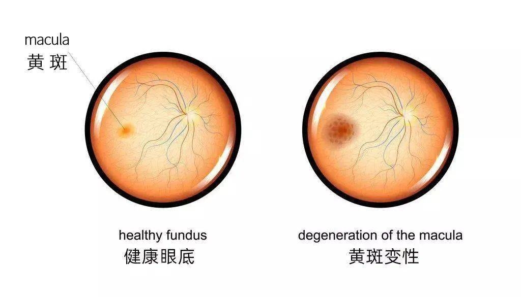 葉黃素對(duì)眼睛真的有效嗎,？一文讀懂它的功效與作用(圖3)